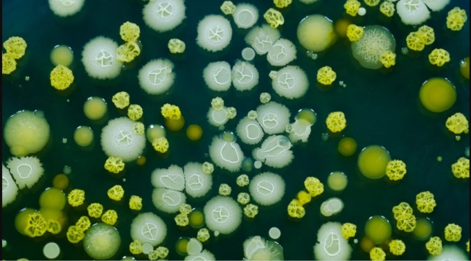 Malattia di Lyme, è stato scoperto perchè gli antibiotici spesso non bastano