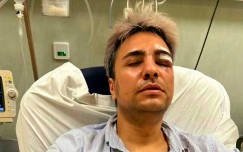 Aggressione omofoba in centro, ferito giovane di 25 anni