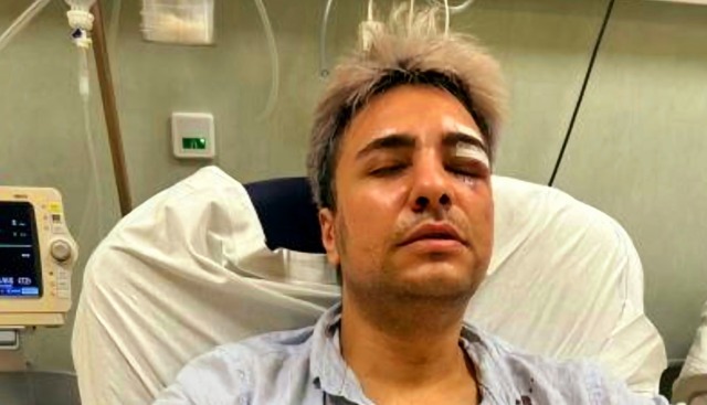 Aggressione omofoba in centro, ferito giovane di 25 anni
