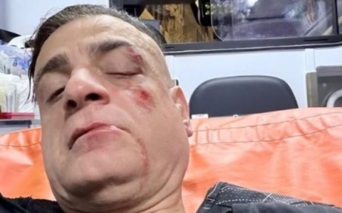 Lo youtuber ‘Cicalone’ aggredito alla fermata Ottaviano da 10 borseggiatori