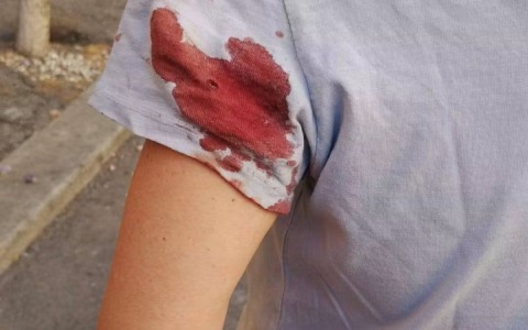 Donna ferita con arma ad aria compressa, perquisizioni a Roma