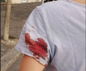Giornalista ferita in strada, sopralluogo del Ris